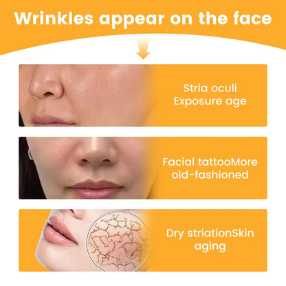 EELHOE Nasolabial Folds Patch, Fade Fine Lines Law Lines Lifting And Tightening Facial Skin Moisturizing And Hydrating